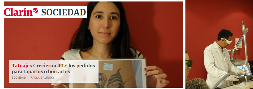 Diario Clarin: nota sobre Borrado de Tatuajes con Lser