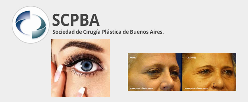 Disertacin sobre Lser aplicado en zona Periorbital