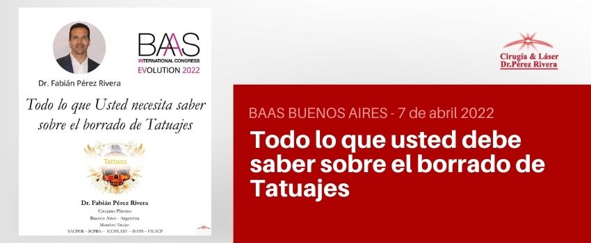 Todo lo que ud necesita saber sobre el borrado de tatuajes